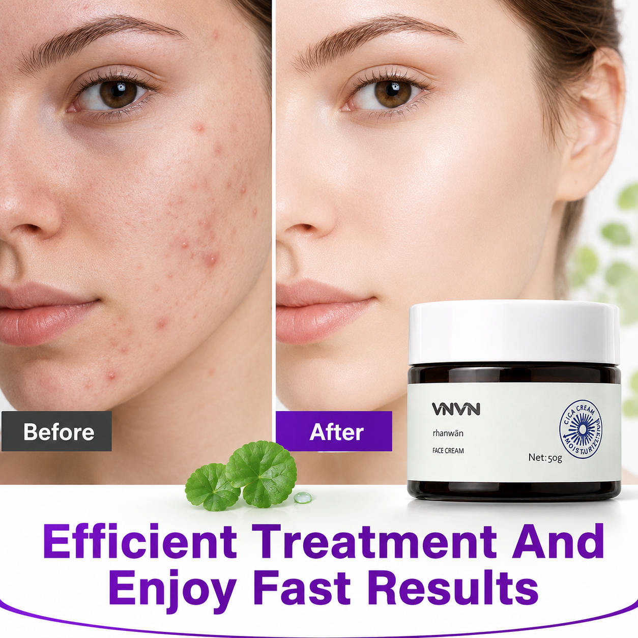 Red Blemish Cica Soothing Cream, 1 pack, 50g